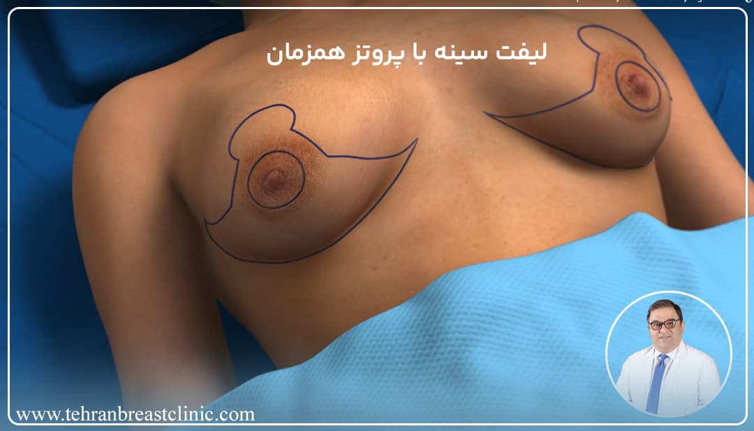پروتز سينه چیست+جراحی پروتز سینه ارزان+قیمت پروتز سینه زنان+عوارض پروتز سینه زنان+سولاریوم و پروتز سینه