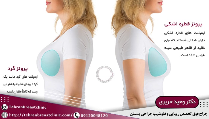 پروتز سینه اشکی