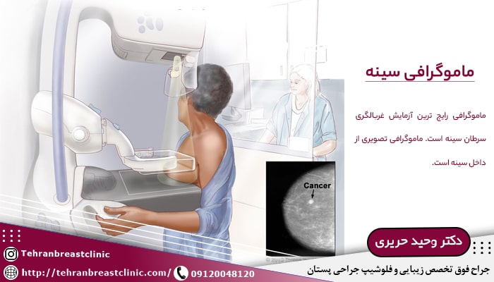 ماموگرافی برای سرطان سینه