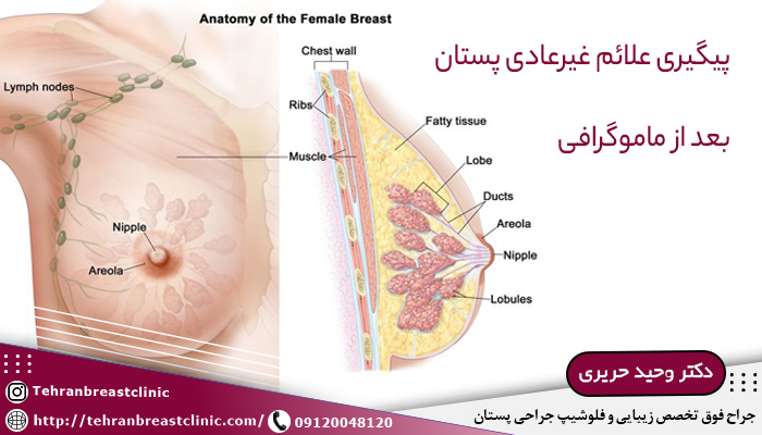 پیگیری علائم غیرعادی پستان بعد از ماموگرافی