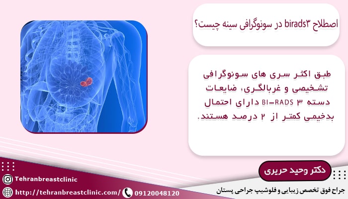 اصطلاح birads3 در سونوگرافی سینه
