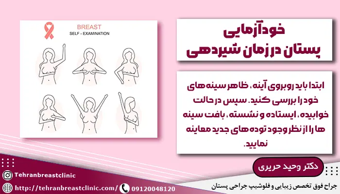 خودآزمایی پستان در دوران شیردهی