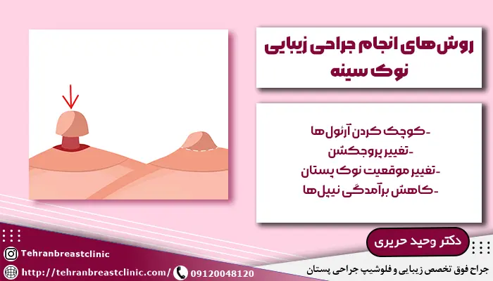 روش های جراحی نوک سینه