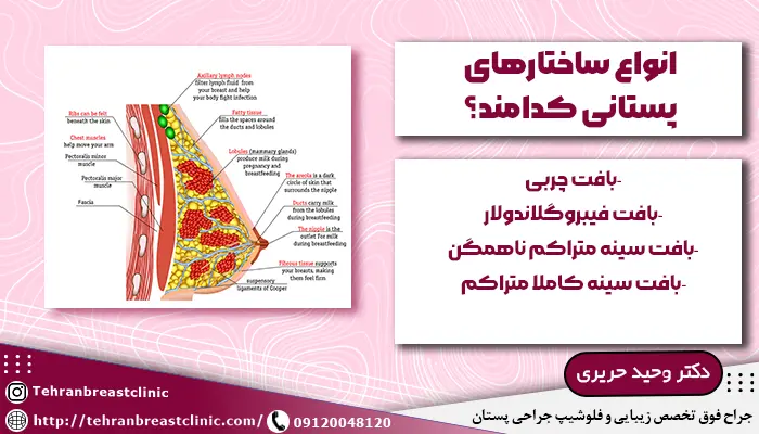 تفاوت فیبروگلاندولار با سایر ساختارهای پستانی