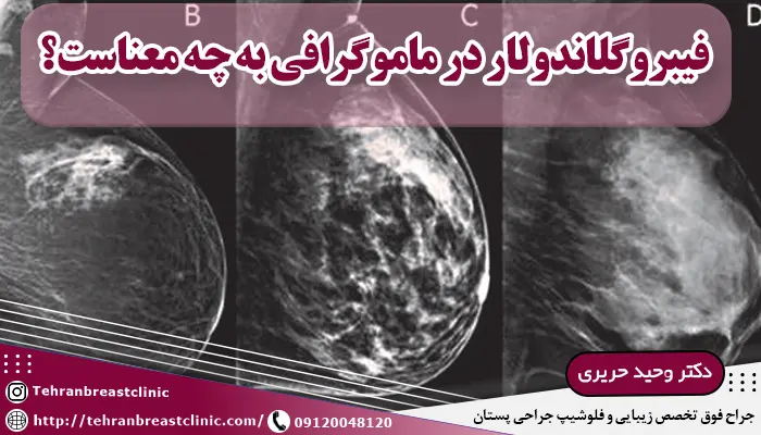 بافت فیبروگلاندولار چیست