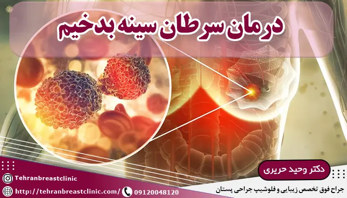 آیا سرطان سينه بدخيم قابل درمان است؟ درمان قطعی سرطان بدخیم