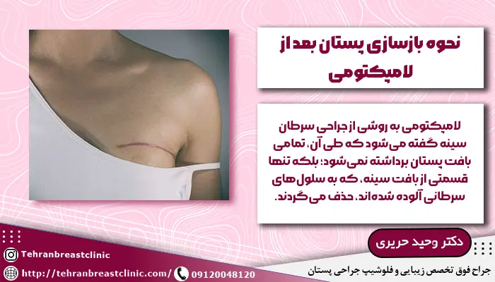 تصویر زنی که تحت عمل بازسازی سینه بعد از لامپکتومی قرار گرفته است