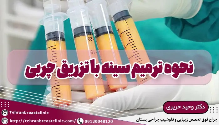 تصویر چربی کشیده شده داخل سرنگ برای ترمیم سینه با تزریق چربی