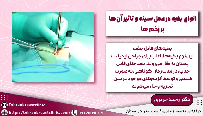 تصویر بخیه زدن سینه بعد از جراحی زیبایی و توضیح انواع نخ بخیه