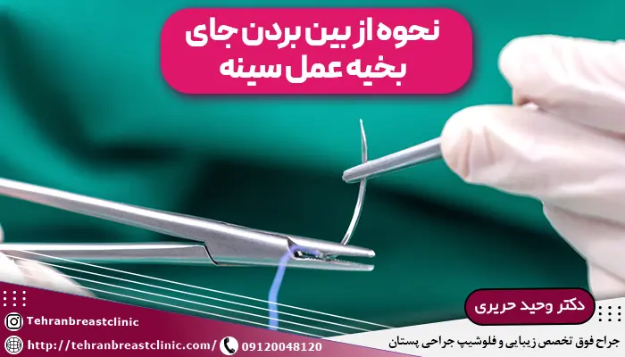 تصویر نخ بخیه و توضیح نحوه از بین بردن جای بخیه بعد از عمل سینه