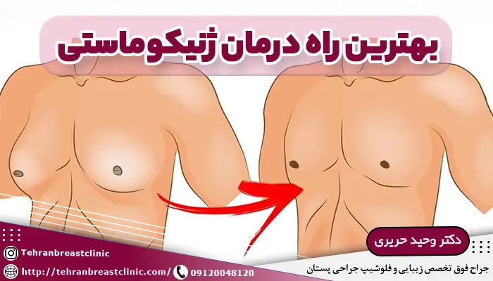 تصویر قبل و بعد درمان ژنیکوماستی