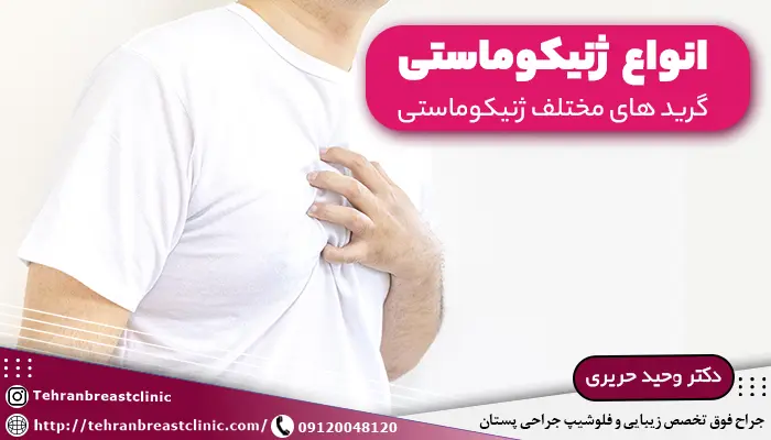 انواع ژنیکوماستی