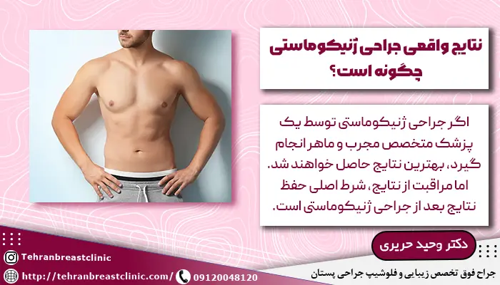 تصویر مردی که ژنیکوماستی انجام داده و با انتظار واقعی از جراحی ژنیکوماستی رضایت دارد