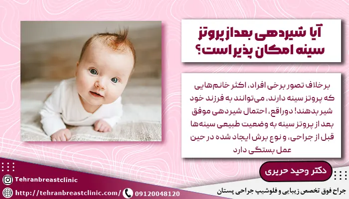 آیا شیردهی بعداز پروتز سينه امکان پذیر است؟