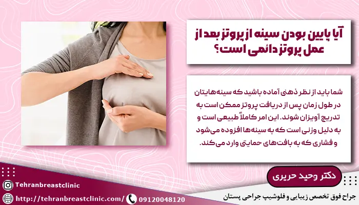 آیا پايين بودن سينه از پروتز بعد از عمل پروتز دائمی است؟