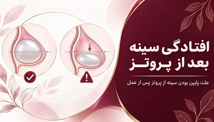 پايين بودن سينه از پروتز بعد از عمل پروتز؛ علت افتادگی سینه بعد از پروتز