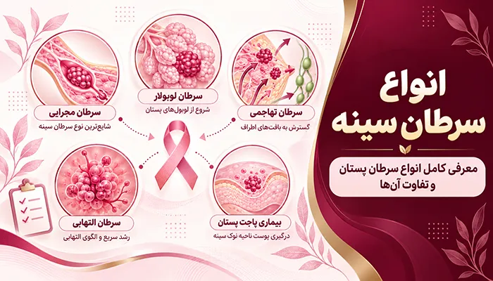 انواع سرطان سینه؛ معرفی کامل انواع سرطان پستان و تفاوت آن‌ها