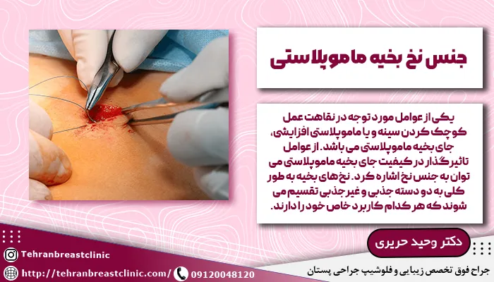 جنس نخ بخیه ماموپلاستی