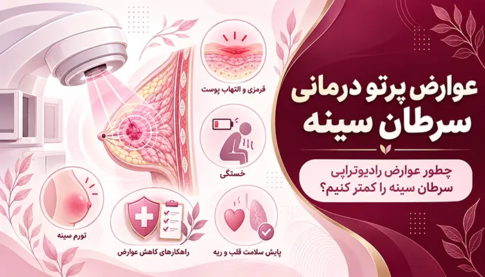 عوارض پرتو درمانی سرطان سینه؛ چطور عوارض رادیوتراپی سرطان سینه را کمتر کنیم؟