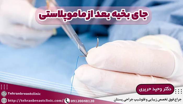 جای بخیه بعد از ماموپلاستی