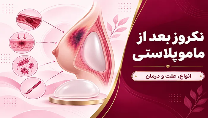 توده بعد از ماموپلاستی؛ انواع، علت و درمان نکروز بعد از ماموپلاستی