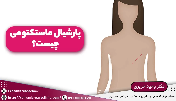 پارشیال ماستکتومی چیست؟