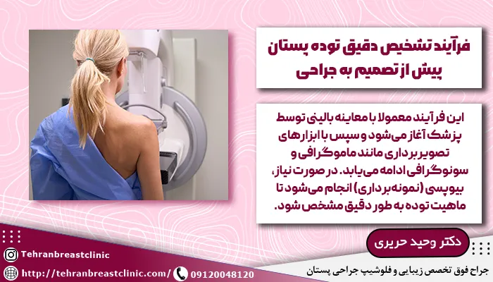 تشخیص توده پستان
