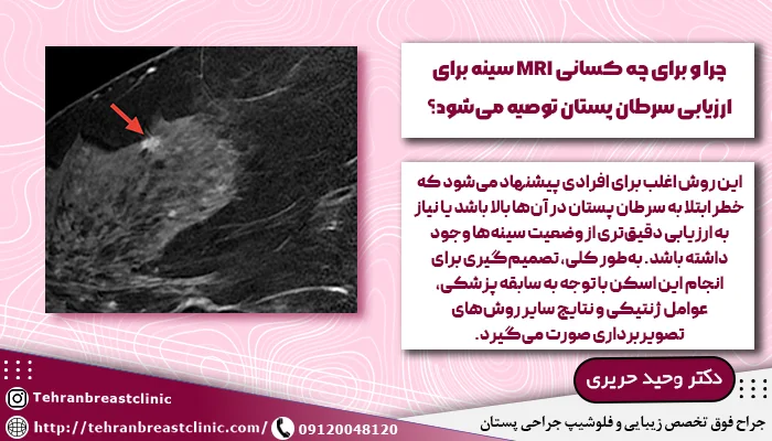 MRI سینه برای ارزیابی سرطان پستان
