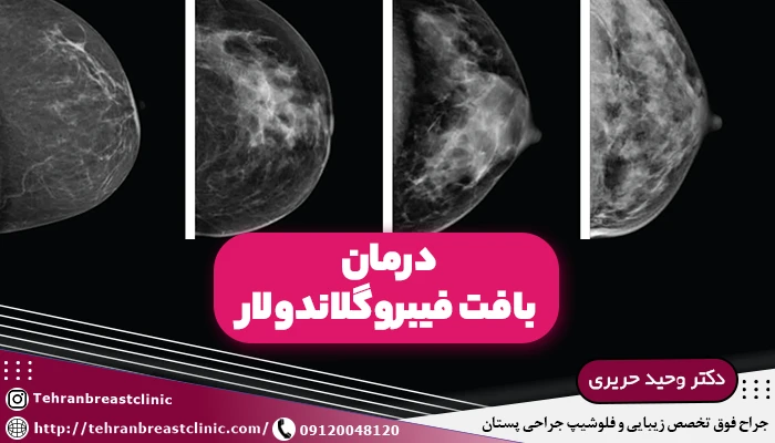 درمان بافت فیبروگلاندولار