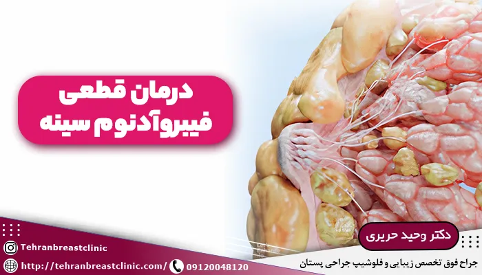 درمان قطعی فیبروآدنوم سینه