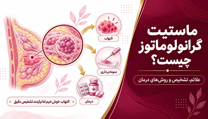 ماستیت گرانولوماتوز چیست؛ بررسی روش‌های درمان و درمان قطعی ماستیت گرانولوماتوز