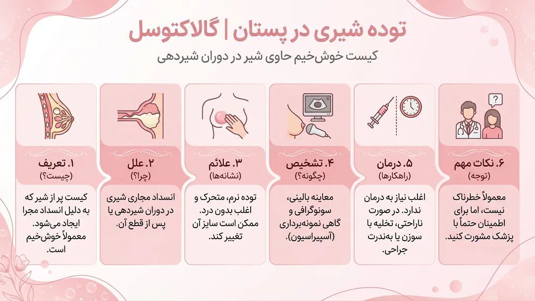 توده شیری پستان گالاکتوسل