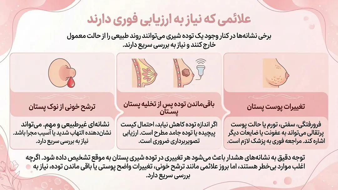 علائم مهم در توده شیری گالاکتوسل