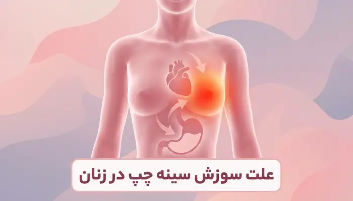 علت سوزش سينه چپ در زنان