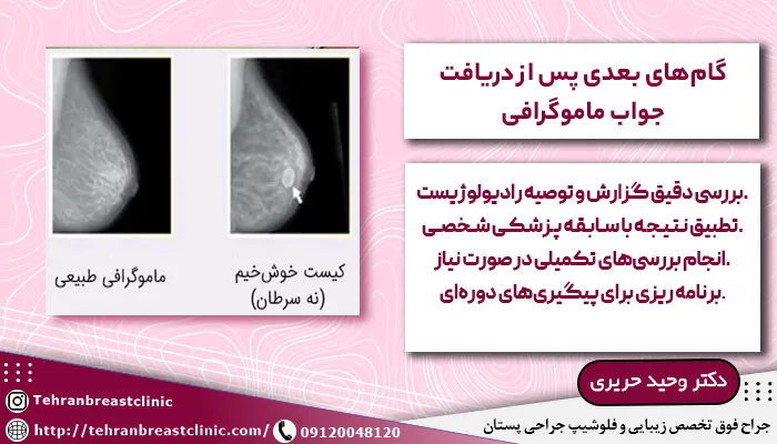 گامهای بعدی پس از دریافت جواب ماموگرافی