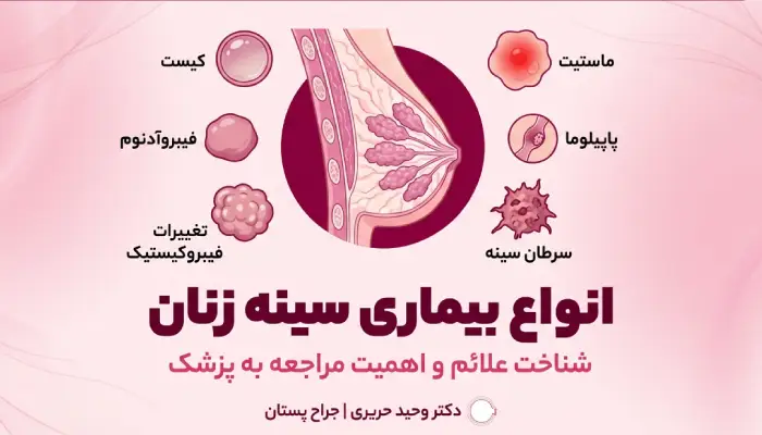 بیماری سینه زنان