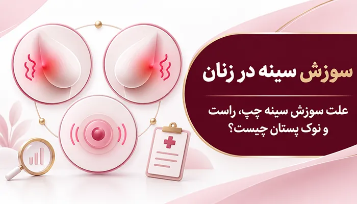 علت سوزش پستان‌ها در زنان؛ سوزش سینه چپ، راست و نوک پستان