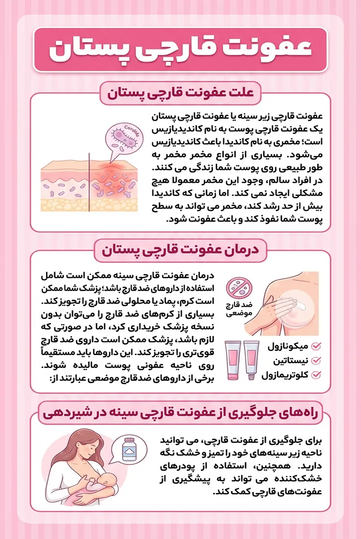 علت عفونت قارچی پستان، درمان عفونت قارچی پستان، پیشگیری از عفونت قارچی پستان