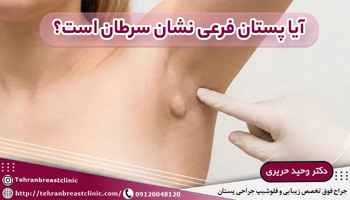آیا پستان فرعی نشان سرطان است؟