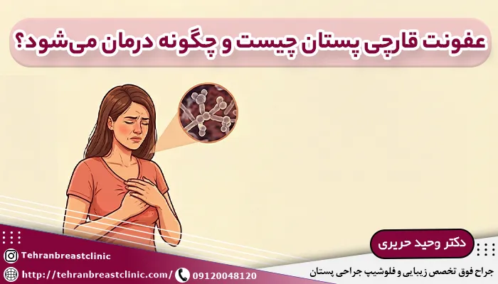 عفونت قارچی پستان چیست؟