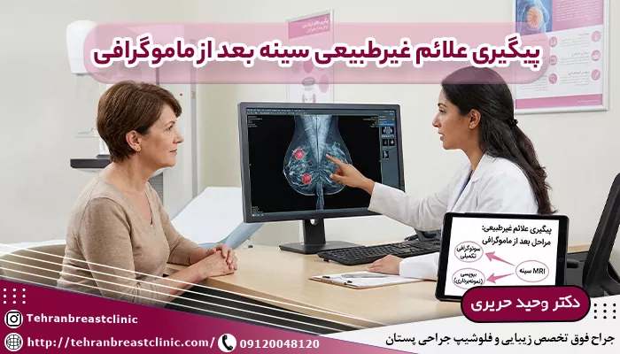 پیگیری علائم غیرعادی پستان بعد از ماموگرافی