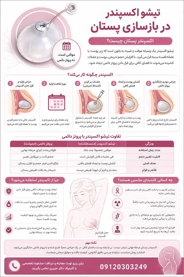 اینفوگرافیک تیشواکپسندر در بازسازی پستان