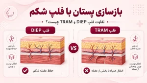 بازسازی پستان با فلپ شکم؛ تفاوت فلپ DIEP و TRAM چیست؟