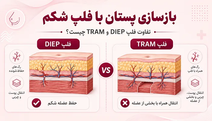 بازسازی پستان با فلپ شکم؛ تفاوت فلپ DIEP و TRAM چیست؟