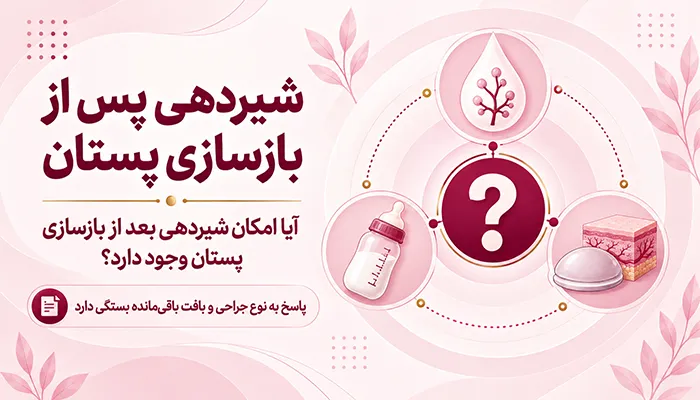 شیردهی پس از بازسازی پستان؛ آیا امکان شیردهی بعد از بازسازی پستان وجود دارد؟