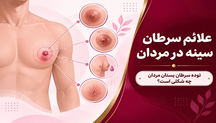 علائم سرطان سینه در مردان؛ توده سرطان پستان مردان چه شکلی است؟