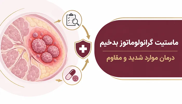 آیا ماستیت گرانولوماتوز بدخیم است؟ درمان موارد شدید و مقاوم بیماری